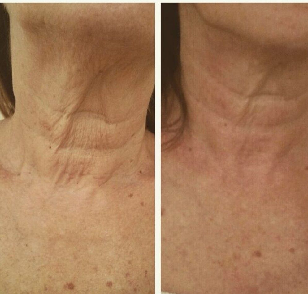 Lymphatic drainage facial treatment at Unique Boutique in Newton Centre, MA